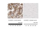 Immunohistochemistry analysis in human small intestine and skeletal muscle tissues using Anti-SLC9A3R1 antibody. Corresponding SLC9A3R1 RNA-seq data are presented for the same tissues.