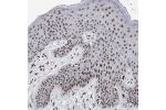 Immunohistochemical staining of human skin shows moderate to strong nuclear positivity in squamous epithelial cells.