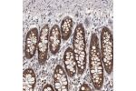 Immunohistochemical staining of human rectum shows strong cytoplasmic positivity in glandular cells.