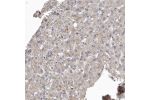 Immunohistochemical staining of human smooth muscle shows strong cytoplasmic positivity in smooth muscle cells.