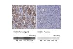 Immunohistochemistry analysis in human adrenal gland and pancreas tissues using Anti-STAR antibody. Corresponding STAR RNA-seq data are presented for the same tissues.