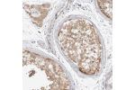 Immunohistochemical staining of human testis shows distinct cytoplasmic positivity in seminiferus duct cells.