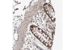 Immunohistochemical staining of human colon shows strong granular cytoplasmic positivity in glandular cells.