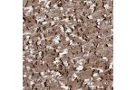 Immunohistochemical staining of human heart muscle shows strong positivity in intercalated discs.