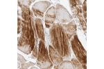 Immunohistochemical staining of human skeletal muscle shows strong cytoplasmic positivity in myocytes.