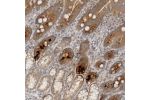 Immunohistochemical staining of human duodenum shows strong cytoplasm granular positivity in glandular cells.