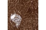 Immunohistochemical staining of human liver shows strong cytoplasmic positivity in hepatocytes.