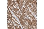 Immunohistochemical staining of human heart muscle shows strong cytoplasmic positivity in myocytes.