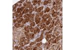 Immunohistochemical staining of human adrenal gland shows strong cytoplasmic positivity in glandular cells.