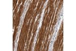 Immunohistochemical staining of human smooth muscle shows distinct cytoplasmic positivity.