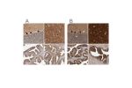 Immunohistochemical staining of human cerebellum, cerebral cortex, fallopian tube and prostate using Anti-BAIAP2 antibody HPA027421 (A) shows similar protein distribution across tissues to independent antibody HPA023310 (B).