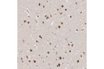 Immunohistochemical staining of human hippocampus shows strong nuclear membranous positivity in neuronal cells.