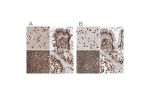 Immunohistochemical staining of human cerebral cortex, colon, lymph node and testis using Anti-PPP1R8 antibody HPA027452 (A) shows similar protein distribution across tissues to independent antibody HPA027406 (B).