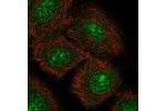 Immunofluorescent staining of human cell line A549 shows localization to nucleoli & nuclear membrane.