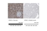 Immunohistochemical staining of human pancreas shows moderate cytoplasmic positivity in exocrine glandular cells.