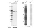 Western blot analysis in human cell lines Caco-2 and SK-MEL-30 using Anti-C1orf106 antibody. Corresponding C1orf106 RNA-seq data are presented for the same cell lines. Loading control: Anti-HDAC1.