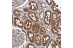 Immunohistochemical staining of human kidney shows strong cytoplasmic and membranous positivity in cells in tubules.