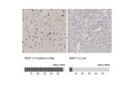 Immunohistochemistry analysis in human cerebral cortex and liver tissues using HPA027524 antibody. Corresponding ZEB1 RNA-seq data are presented for the same tissues.