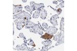 Immunohistochemical staining of human gall bladder shows distinct positivity in plasma.