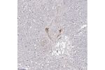 Immunohistochemical staining of human hypothalamus shows moderate cytoplasmic positivity in a subset of neurons.
