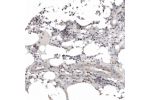 Immunohistochemical staining of human bone marrow shows strong nuclear positivity in hematopoietic cells.