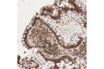 Immunohistochemical staining of human colon shows strong nuclear positivity in glandular cells.
