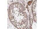 Immunohistochemical staining of human testis shows moderate nuclear and cytoplasmic positivity in cells in seminiferous ducts and Leydig cells.