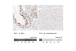 Immunohistochemistry analysis in human testis and cerebral cortex tissues using HPA027573 antibody. Corresponding RCC1 RNA-seq data are presented for the same tissues.