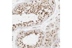 Immunohistochemical staining of human testis shows strong nuclear positivity in spermatocytes and spermatids.