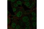 Immunofluorescent staining of human cell line Hep G2 shows localization to nucleoplasm.