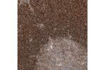Immunohistochemical staining of human Lymph node shows strong membranous and cytoplasmic positivity in non-germinal center cells.