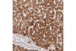 Immunohistochemical staining of human liver shows strong granular cytoplasmic positivity in hepatocytes.