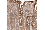 Immunohistochemical staining of human colon shows strong positivity in apical membrane and moderate cytoplasmic staining in glandular cells.