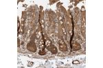 Immunohistochemical staining of human colon shows strong cytoplasmic and membranous positivity in glandular cells.