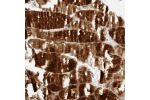Immunohistochemical staining of human skeletal muscle shows strong cytoplasmic positivity in myocytes.