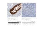 Immunohistochemistry analysis in human cervix, uterine and skeletal muscle tissues using HPA027774 antibody. Corresponding SLPI RNA-seq data are presented for the same tissues.
