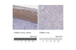 Immunohistochemistry analysis in human cervix, uterine and liver tissues using HPA027797 antibody. Corresponding ITGB8 RNA-seq data are presented for the same tissues.