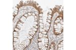 Immunohistochemical staining of human colon shows moderate cytoplasmic and membranous positivity in glandular cells.