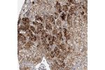 Immunohistochemical staining of human adrenal gland shows strong cytoplasmic and membranous positivity in cortical cells.