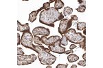 Immunohistochemical staining of human placenta shows strong cytoplasmic positivity in trophoblastic cells.
