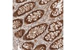 Immunohistochemical staining of human rectum shows strong cytoplasmic and nuclear positivity in glandular cells.