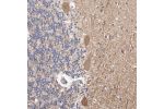 Immunohistochemical staining of human cerebellum shows moderate cytoplasmic positivity in Purkinje cells.