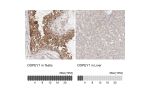 Immunohistochemistry analysis in human testis and liver tissues using Anti-DOPEY1 antibody. Corresponding DOPEY1 RNA-seq data are presented for the same tissues.