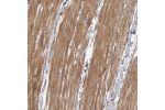 Immunohistochemical staining of human smooth muscle shows distinct cytoplasmic positivity.