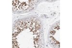 Immunohistochemical staining of human testis shows strong cytoplasmic granular positivity in cells in seminiferous ducts.