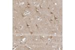 Immunohistochemical staining of human cerebral cortex shows moderate cytoplasmic positivity in neurons.
