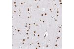 Immunohistochemical staining of human cerebral cortex shows strong nuclear positivity in neurons.