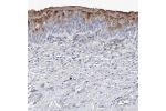 Immunohistochemical staining of human urinary bladder shows moderate cytoplasmic positivity in urothelial cells.