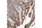 Immunohistochemical staining of human colon shows strong cytoplasmic positivity in glandular cells.