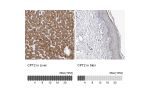 Immunohistochemistry analysis in human liver and skin tissues using HPA028202 antibody. Corresponding CPT2 RNA-seq data are presented for the same tissues.